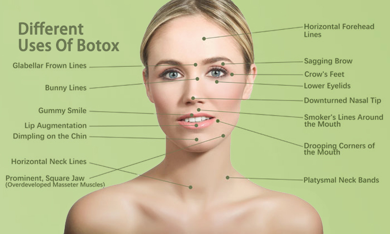 Botox near me for sale